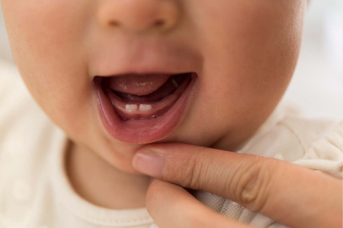 Teething Rash in Babies